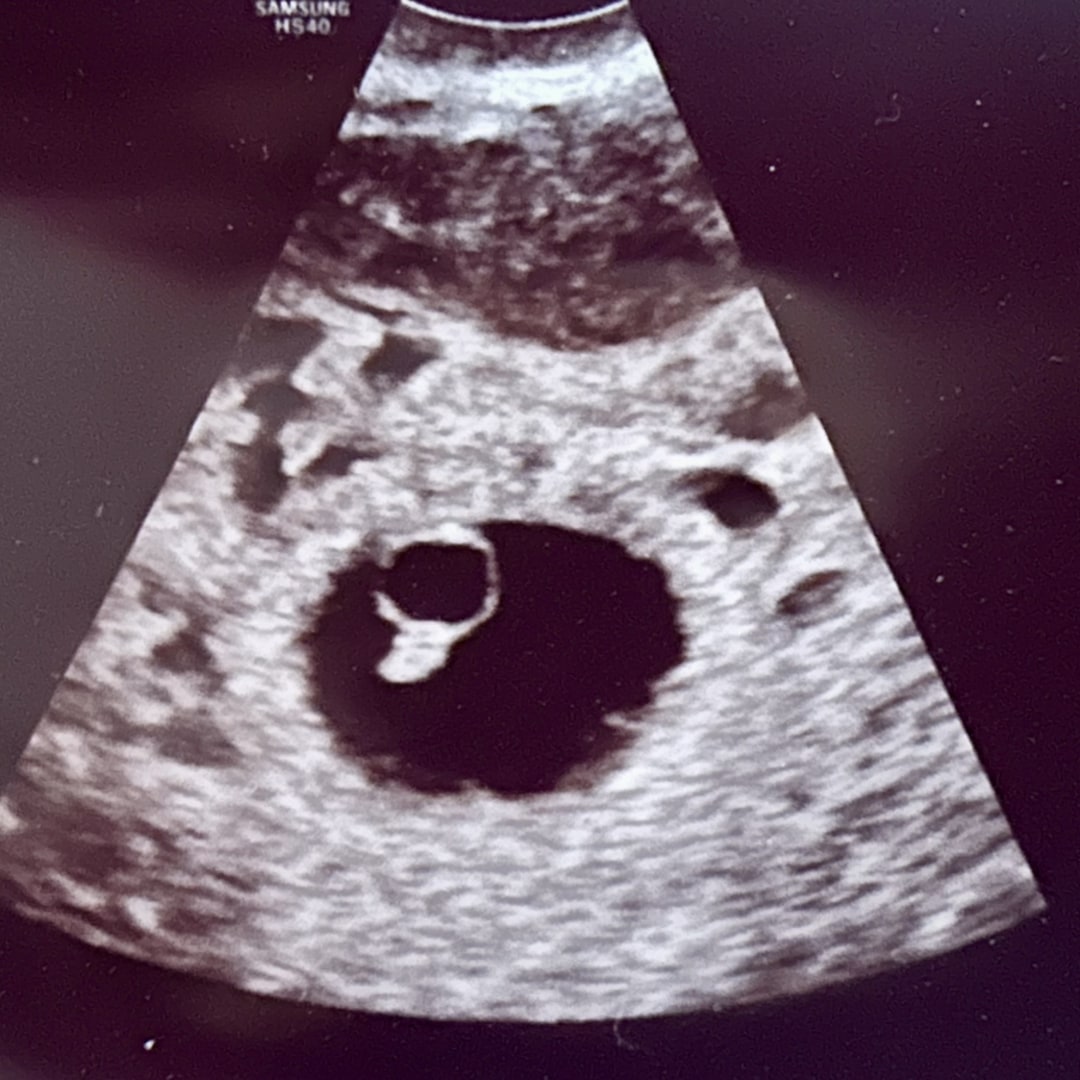 Photo shared by Chelsea for their Babylist baby registry.