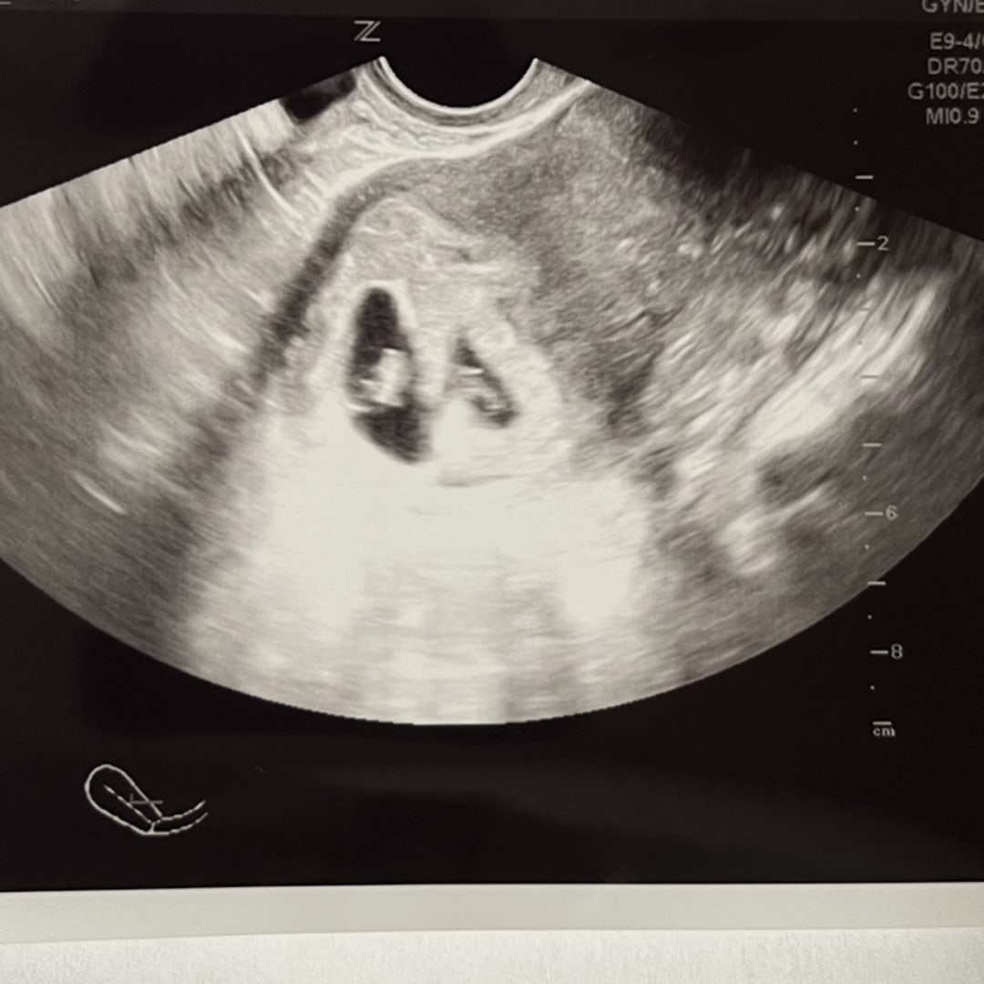 Photo shared by Karol for their Babylist baby registry.