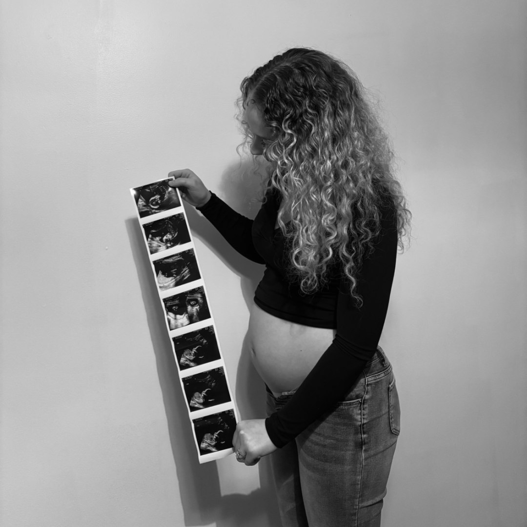 Photo shared by Grace for their Babylist baby registry.