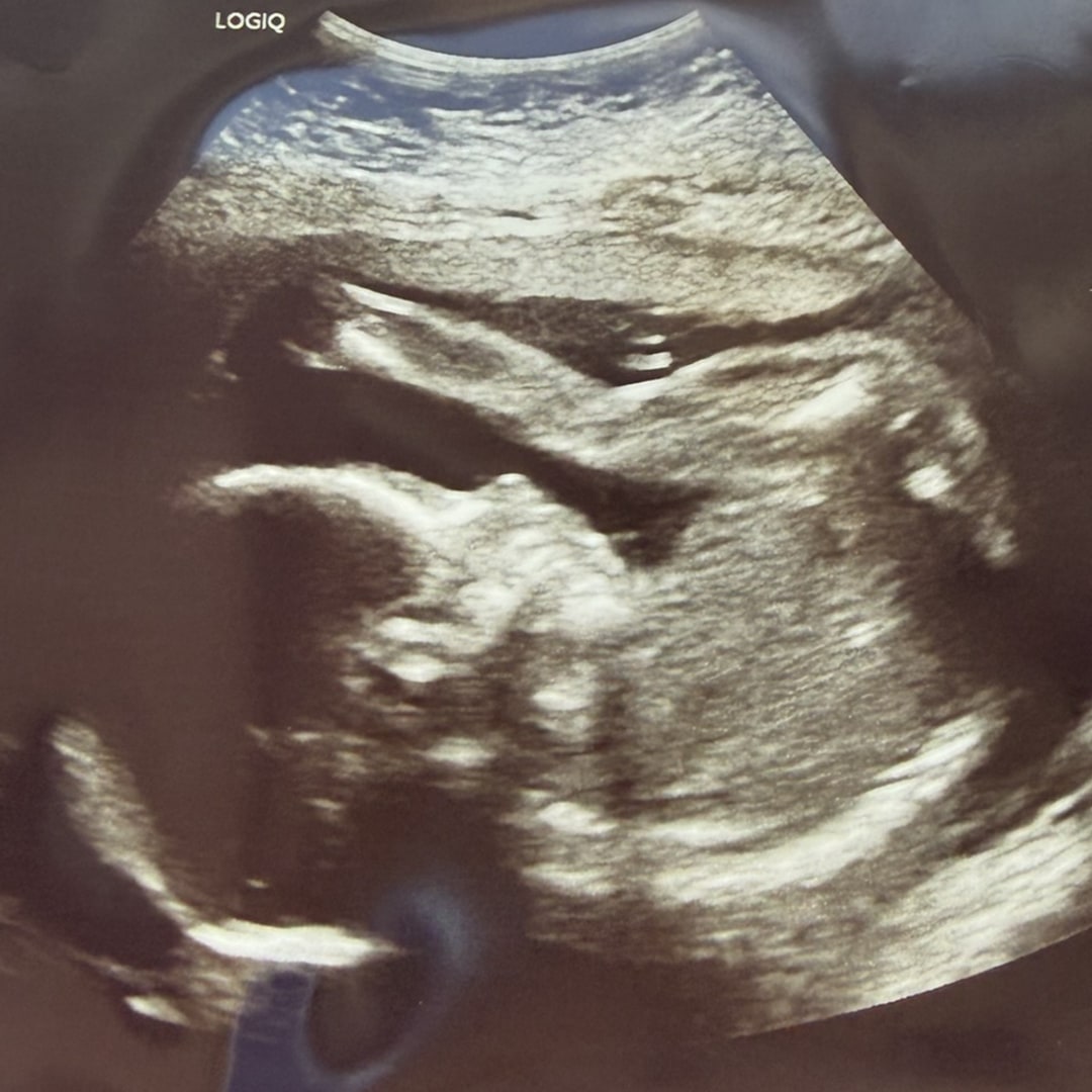 Photo shared by Paige for their Babylist baby registry.