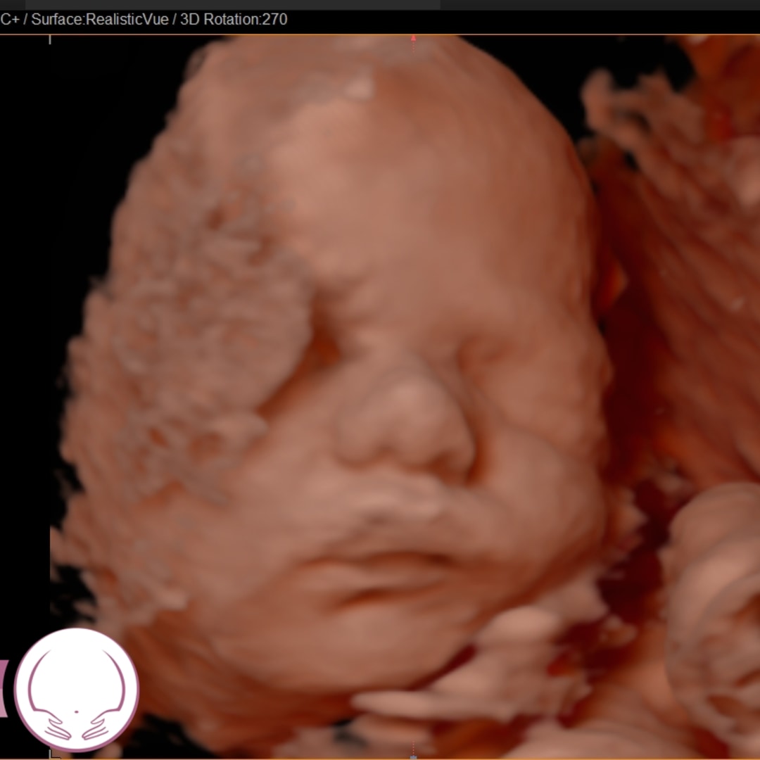 Photo shared by Alex for their Babylist baby registry.