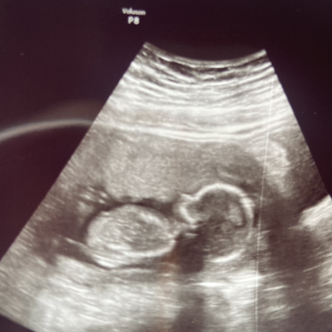 Photo shared by Tiara for their Babylist baby registry.