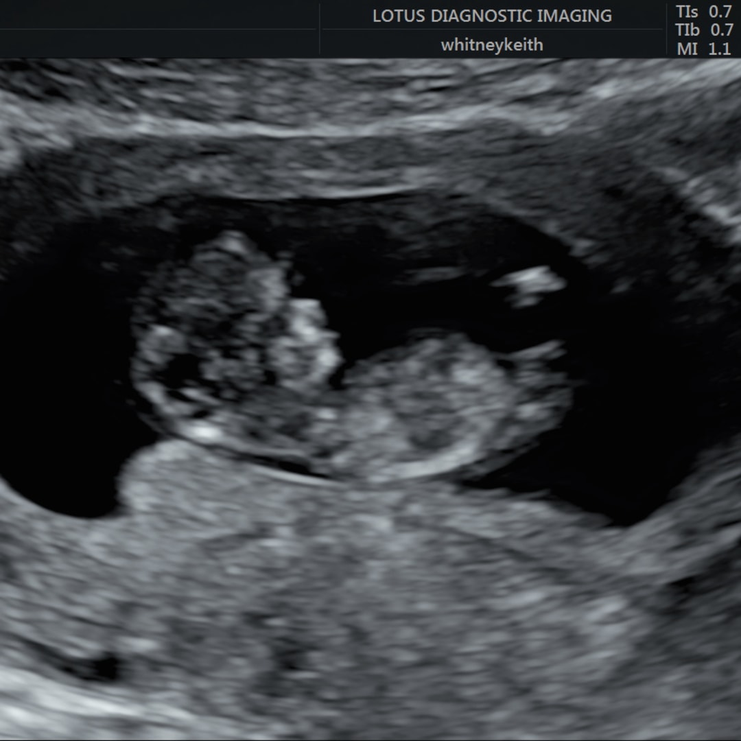 Photo shared by Eve for their Babylist baby registry.