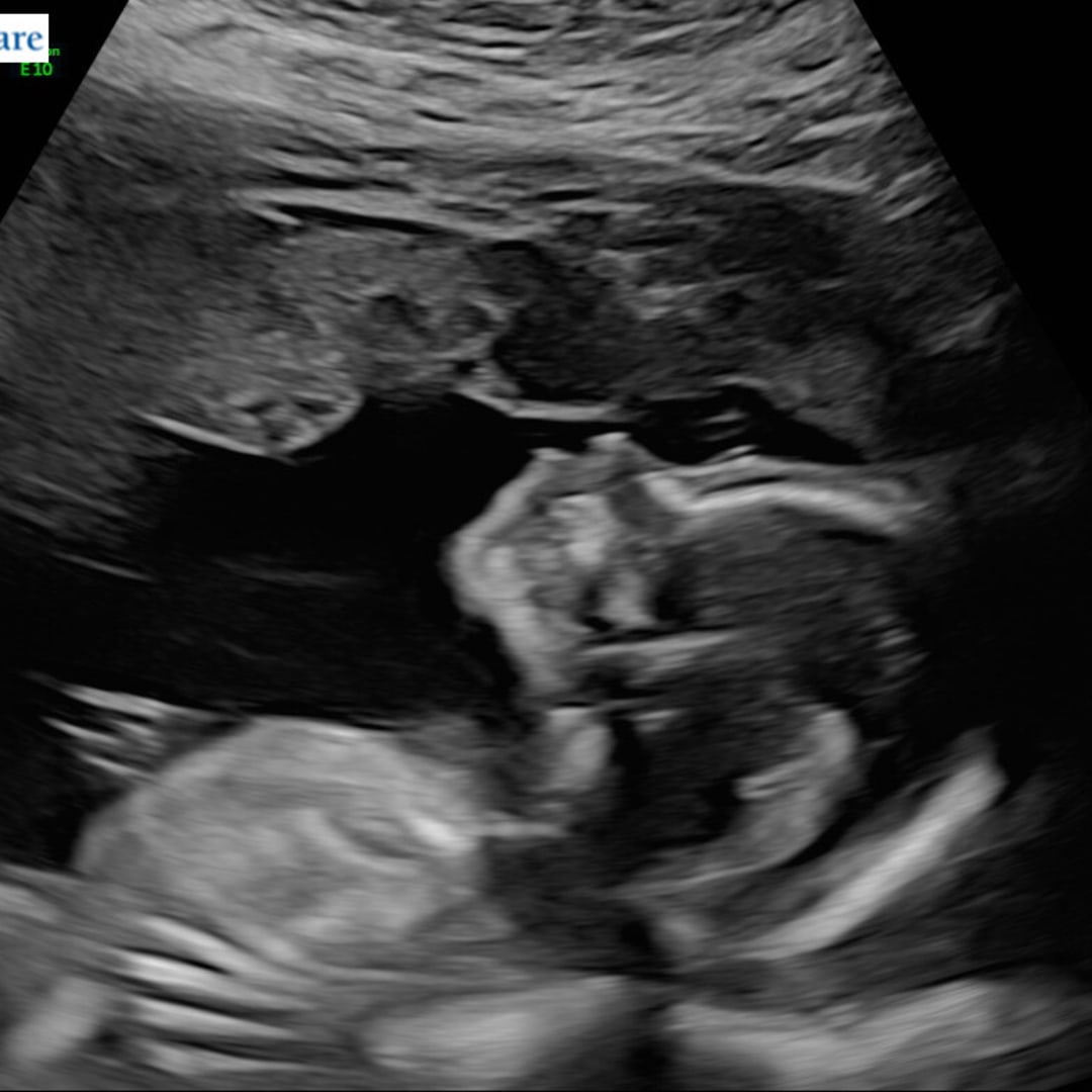 Photo shared by Kaitlyn for their Babylist baby registry.