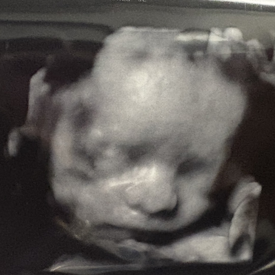 Photo shared by Johana for their Babylist baby registry.