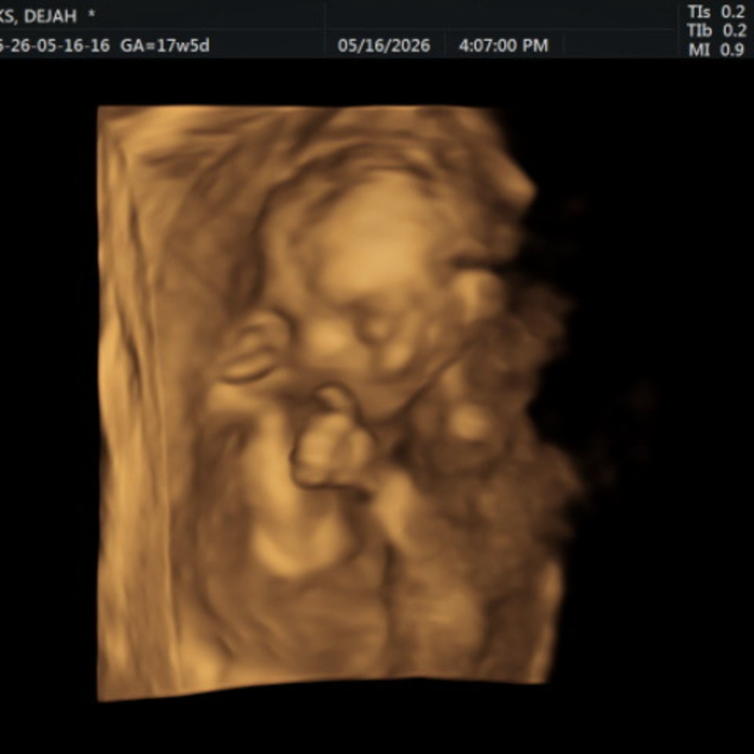 Photo shared by Dejah for their Babylist baby registry.