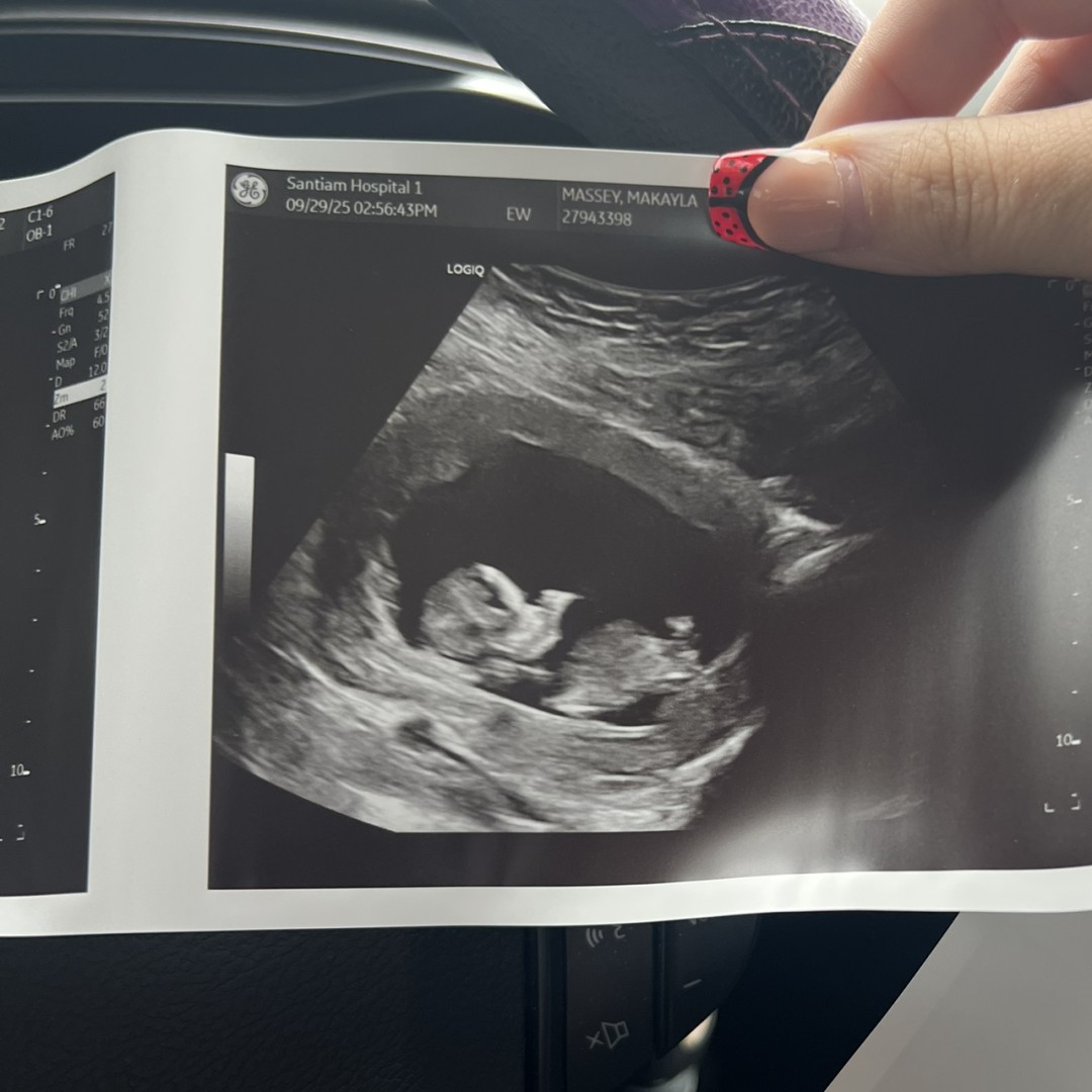 Photo shared by Makayla for their Babylist baby registry.