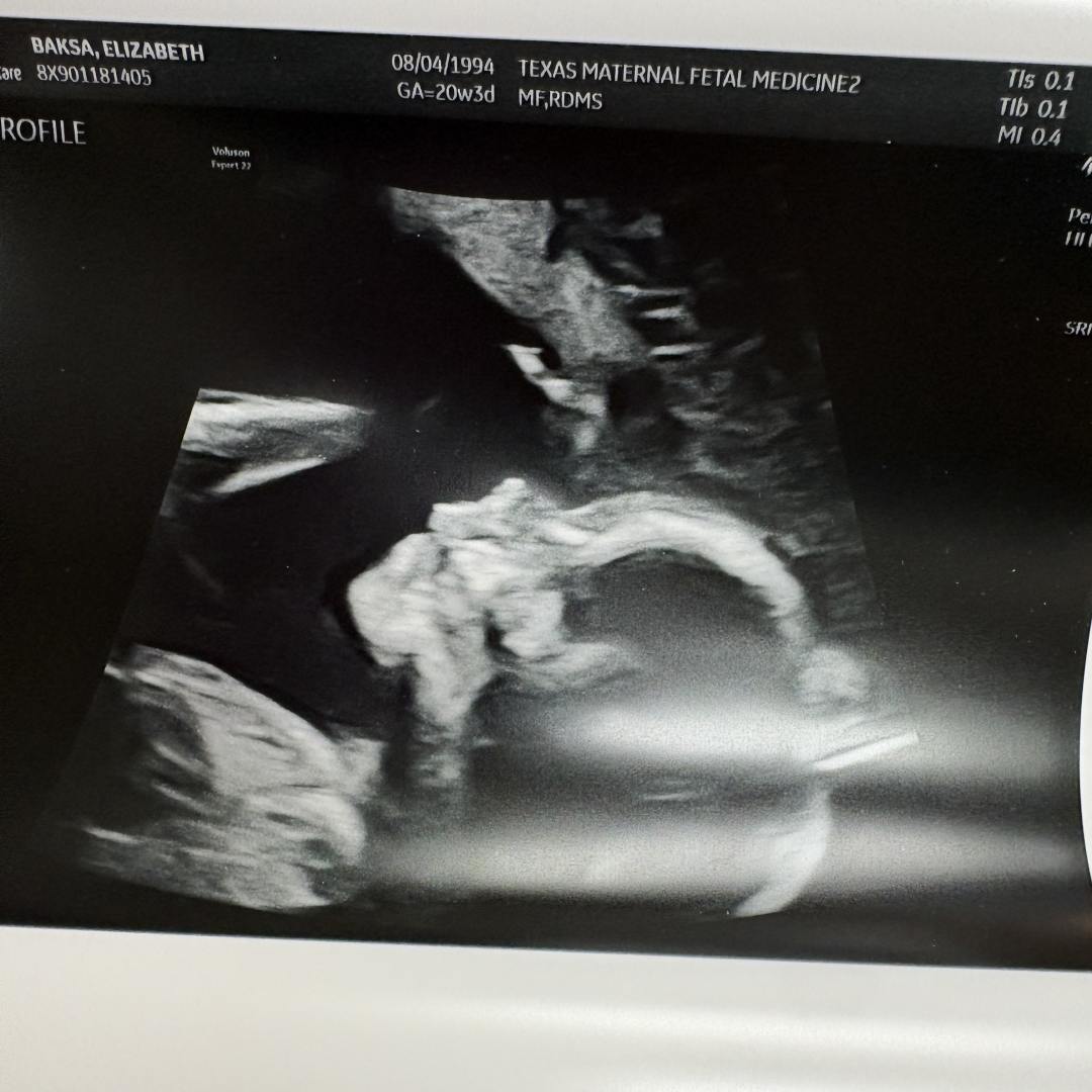 Photo shared by Elizabeth for their Babylist baby registry.