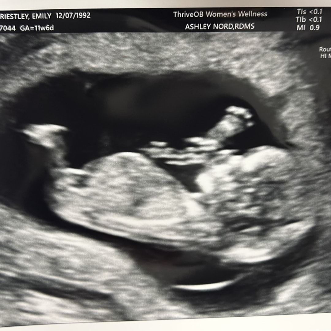 Photo shared by Emily for their Babylist baby registry.