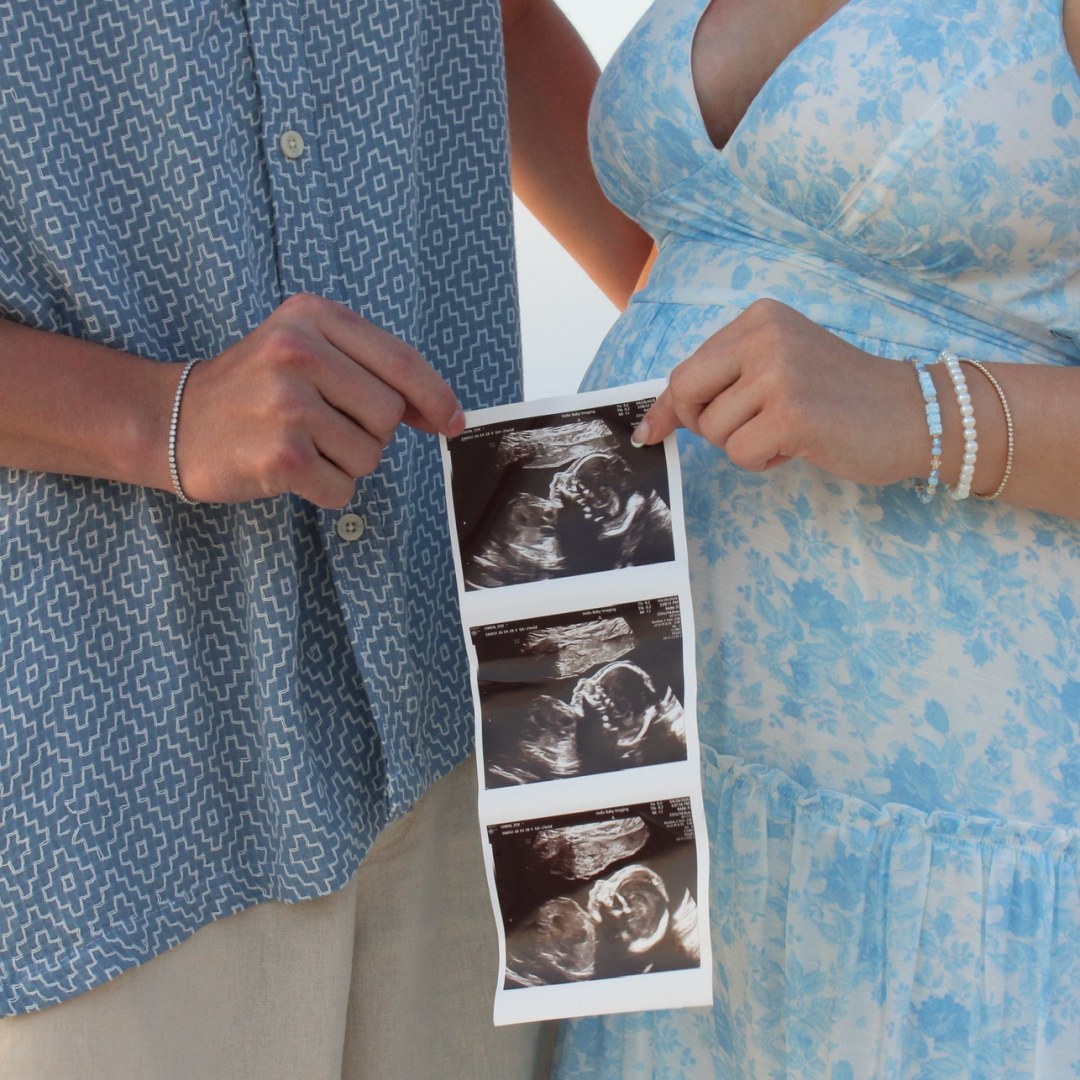 Photo shared by Zoe for their Babylist baby registry.