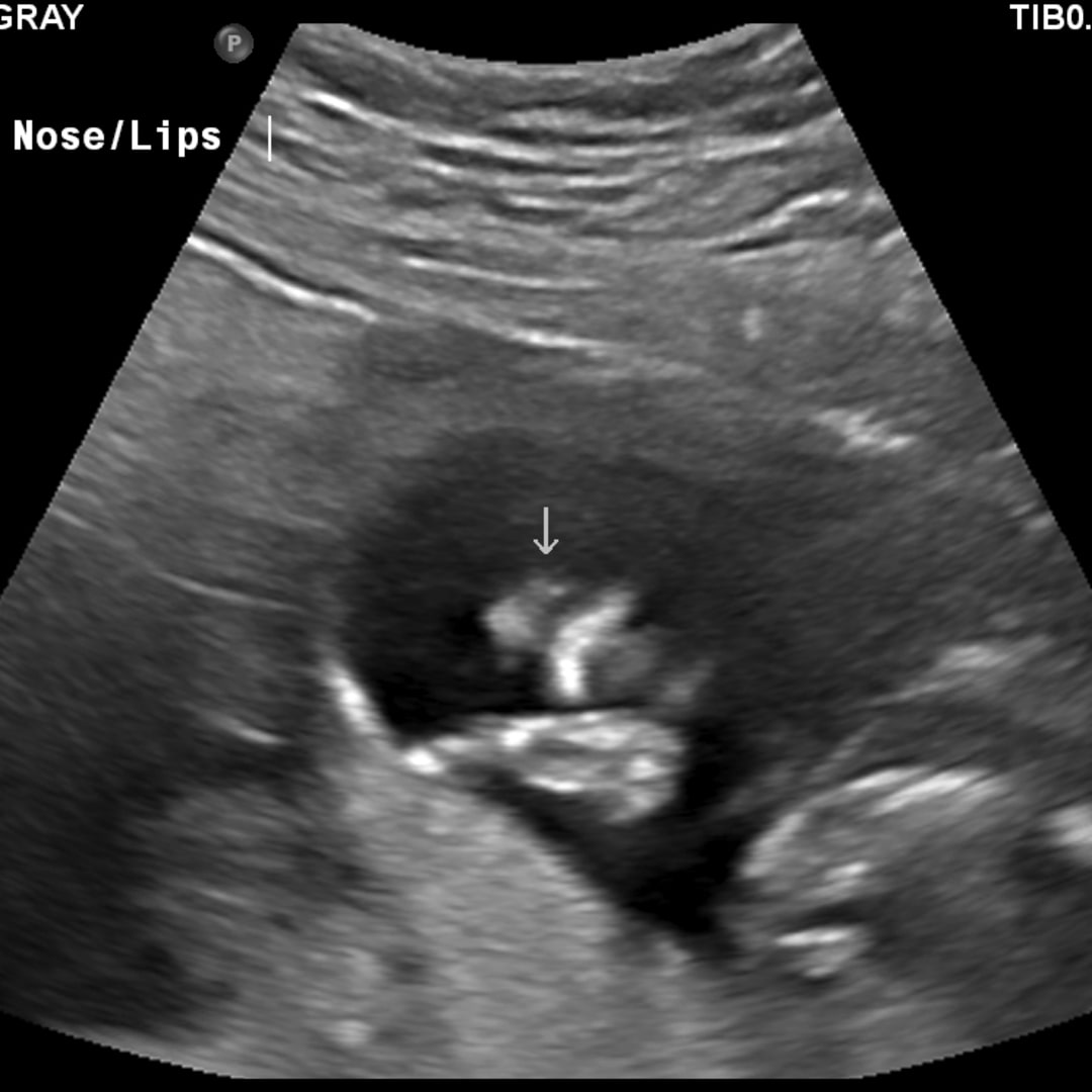 Photo shared by Tara for their Babylist baby registry.