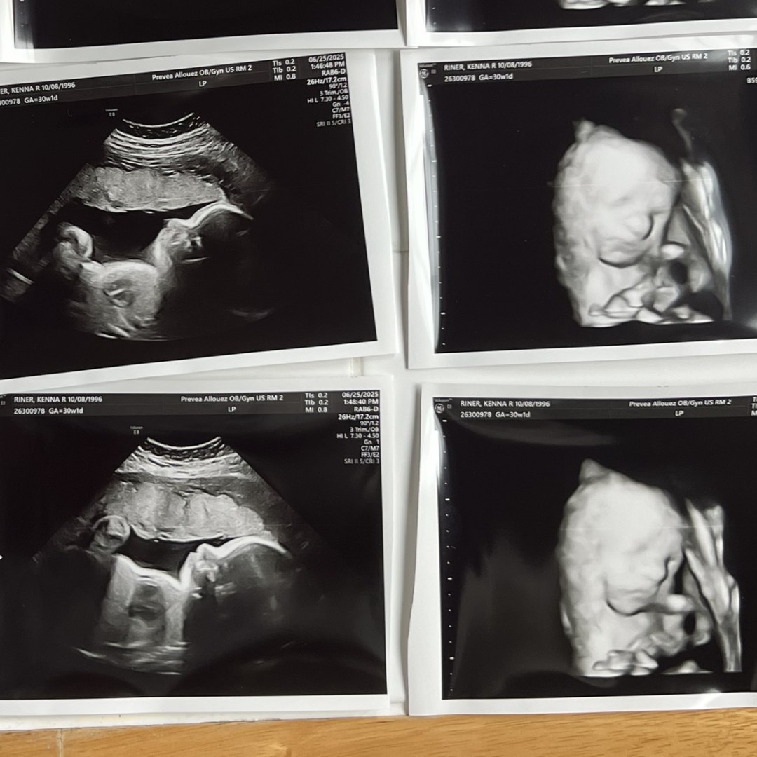 Photo shared by Kenna for their Babylist baby registry.