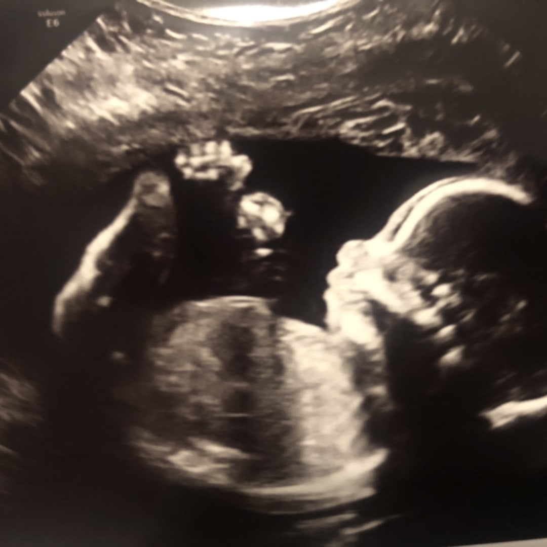 Photo shared by Becca for their Babylist baby registry.