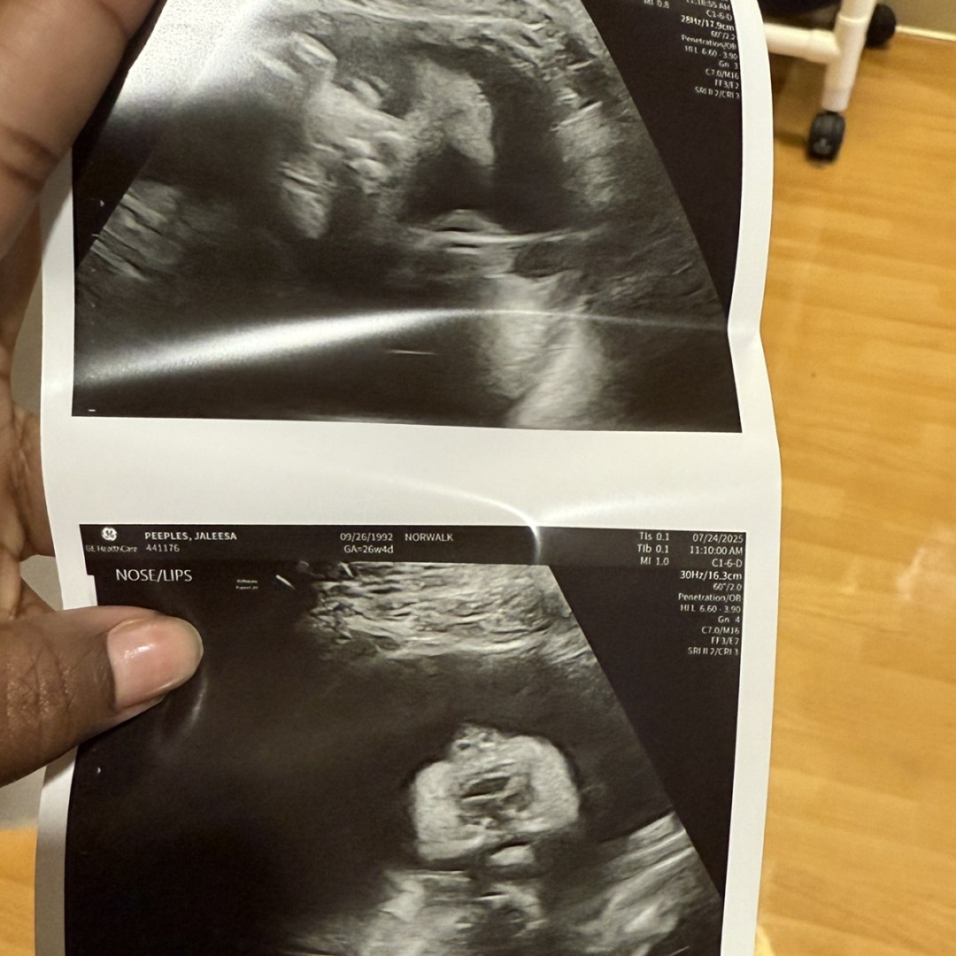 Photo shared by Jaleesa for their Babylist baby registry.