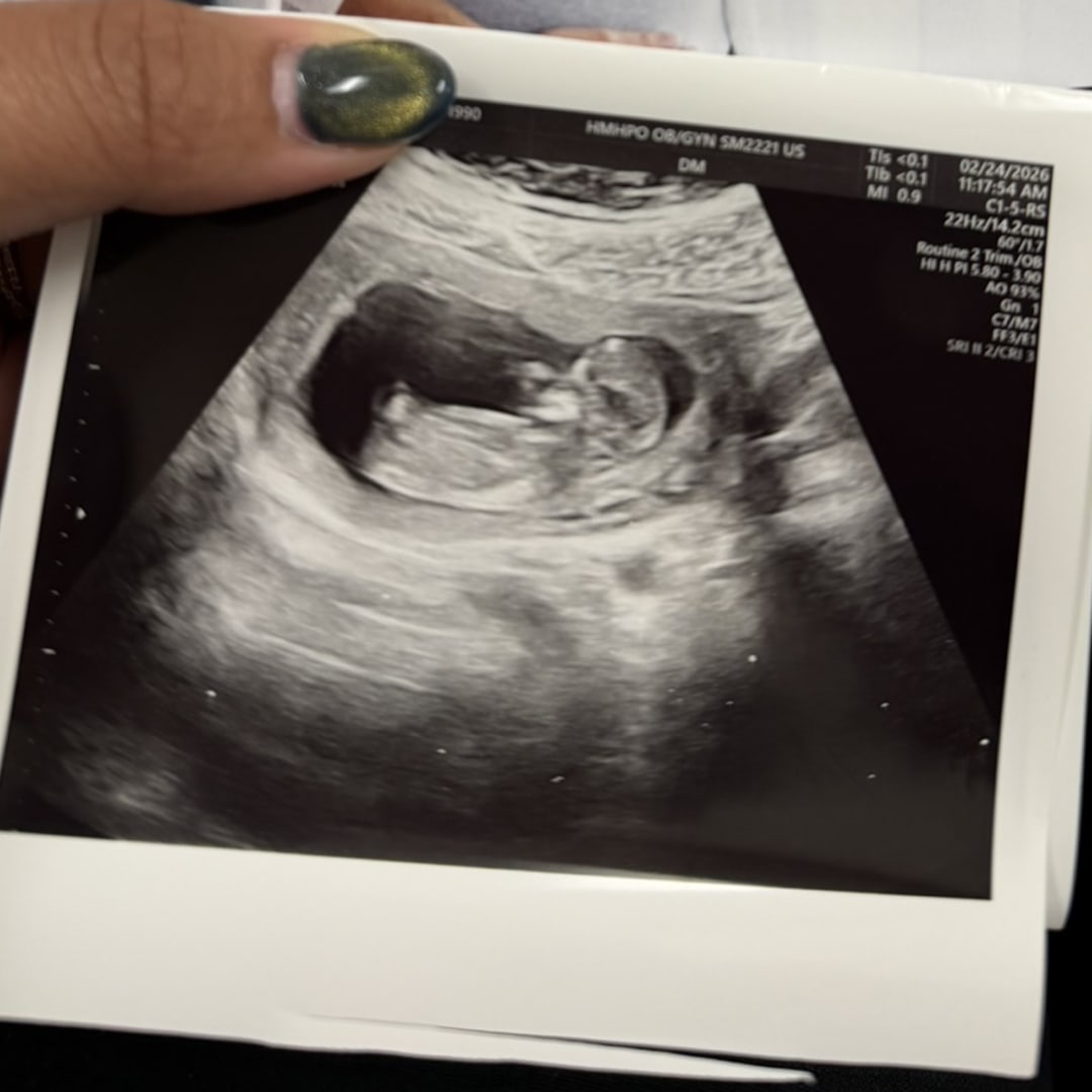 Photo shared by Yezabel Colon for their Babylist baby registry.