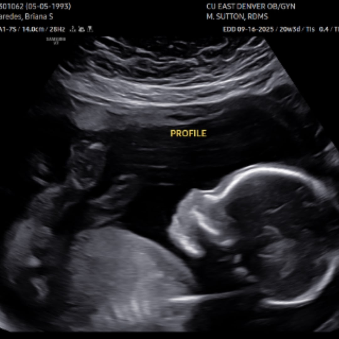 Photo shared by Briana for their Babylist baby registry.