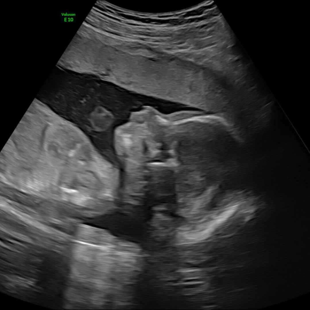Photo shared by Rachel for their Babylist baby registry.