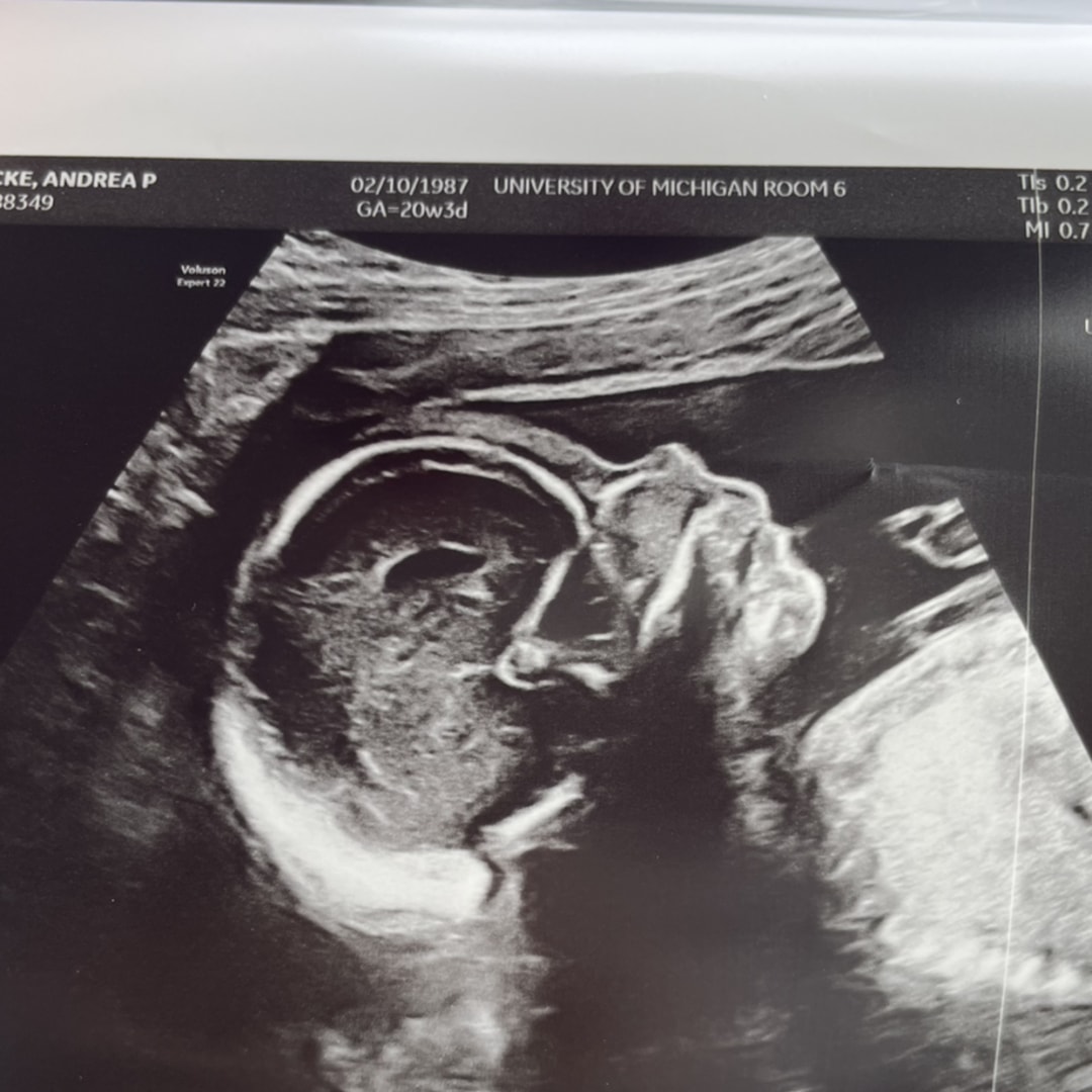 Photo shared by Andie for their Babylist baby registry.