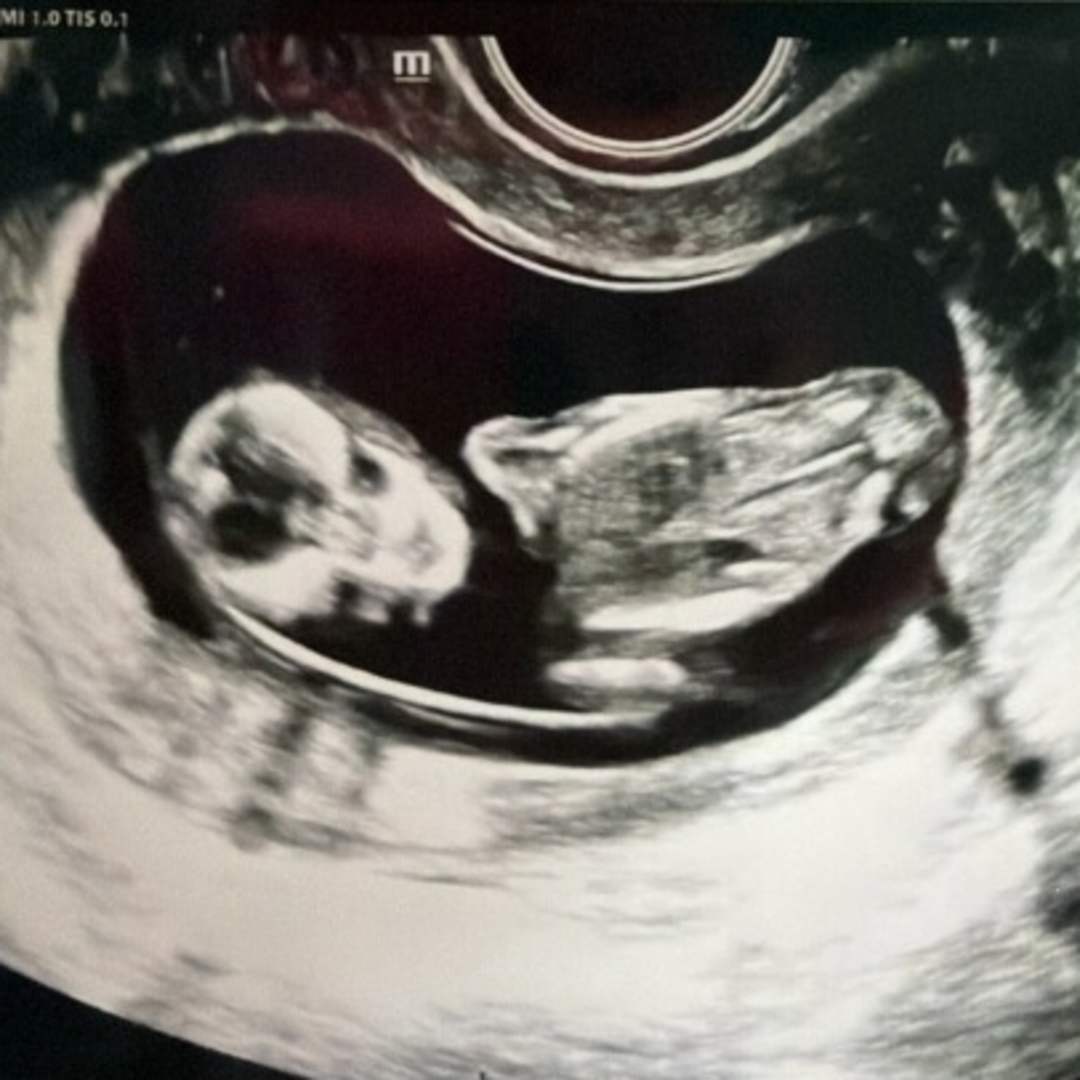 Photo shared by Lisa for their Babylist baby registry.