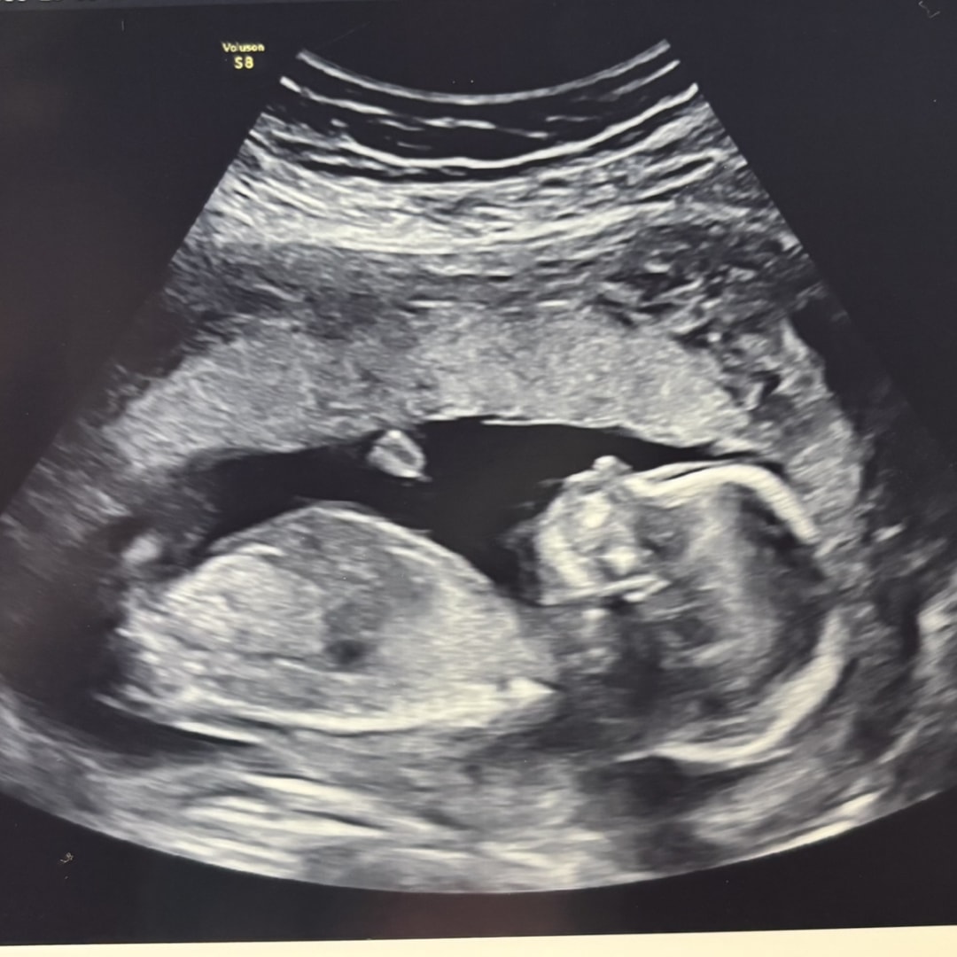 Photo shared by Kailey for their Babylist baby registry.