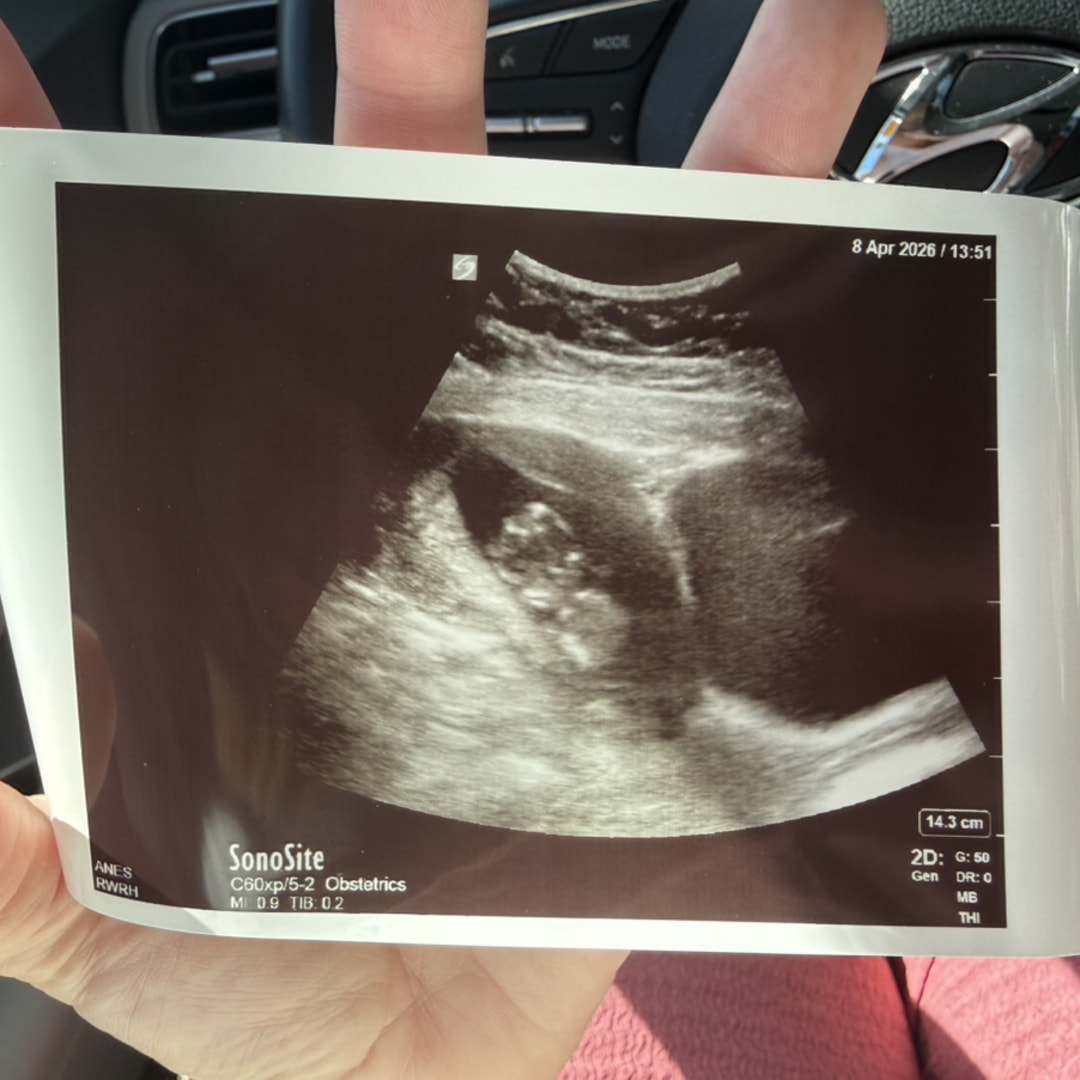 Photo shared by Whitney for their Babylist baby registry.