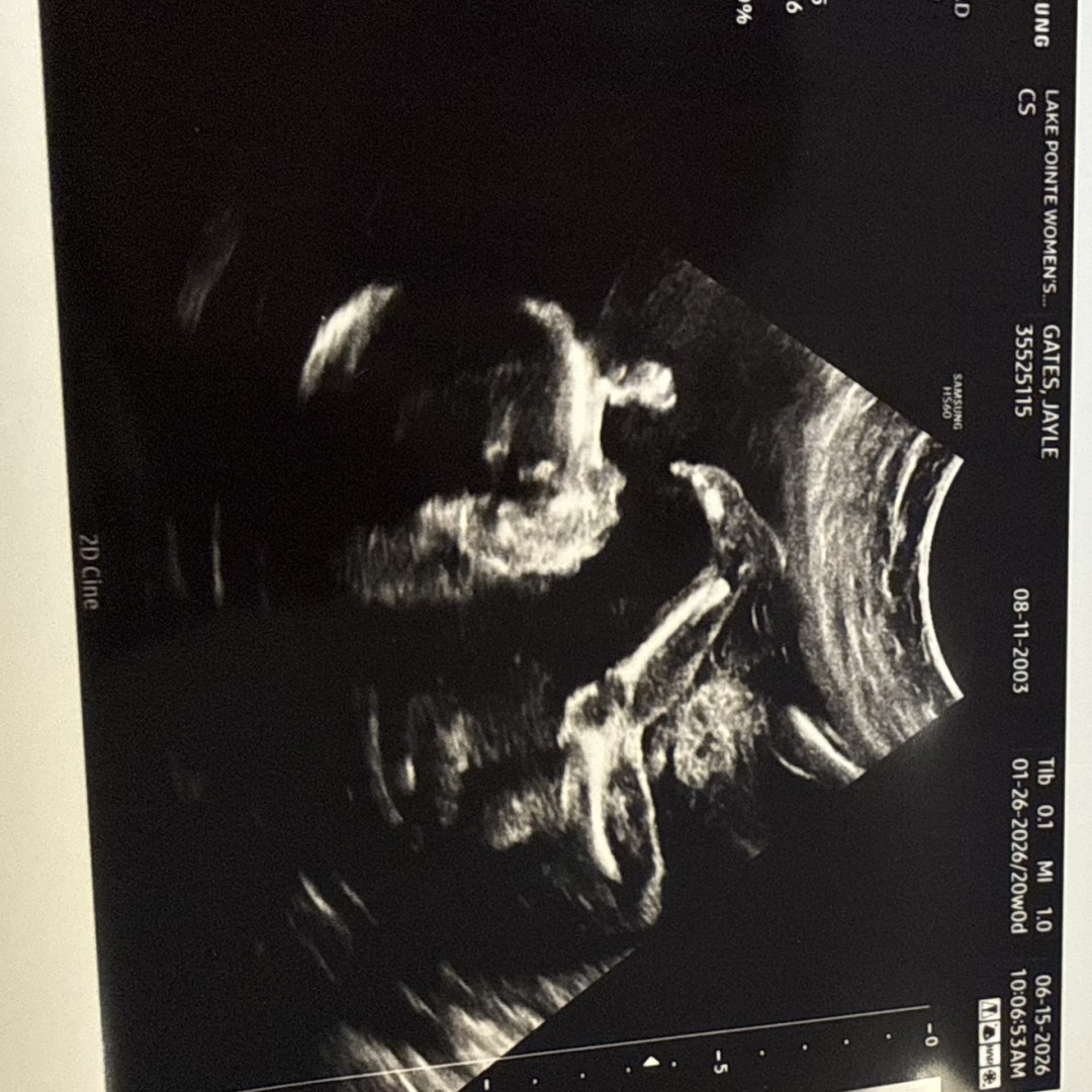 Photo shared by Jayle for their Babylist baby registry.