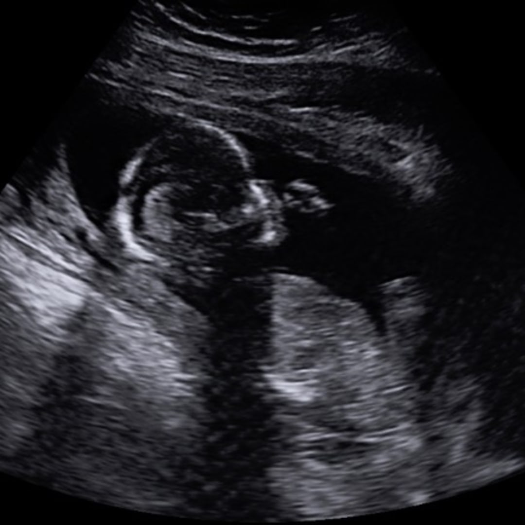 Photo shared by Allana for their Babylist baby registry.