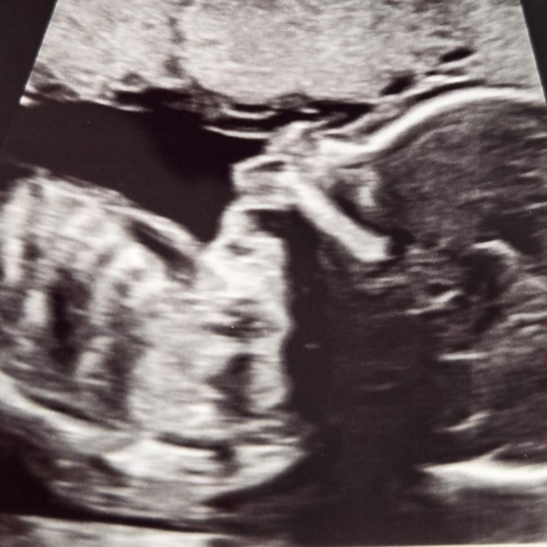 Photo shared by Brian for their Babylist baby registry.