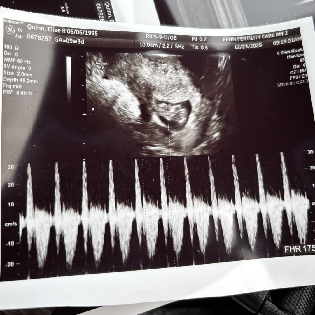 Photo shared by Elise for their Babylist baby registry.