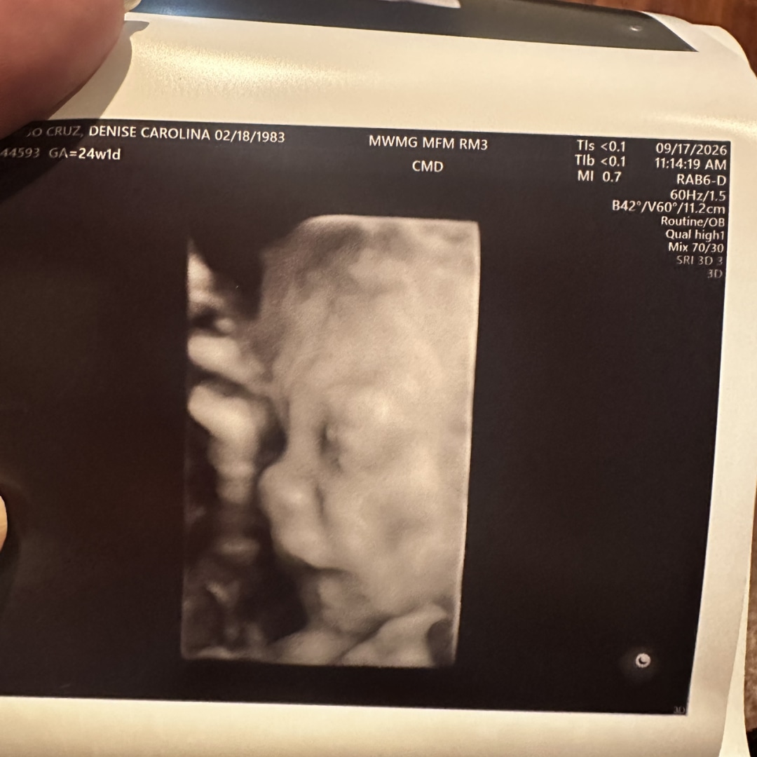 Photo shared by Denise for their Babylist baby registry.
