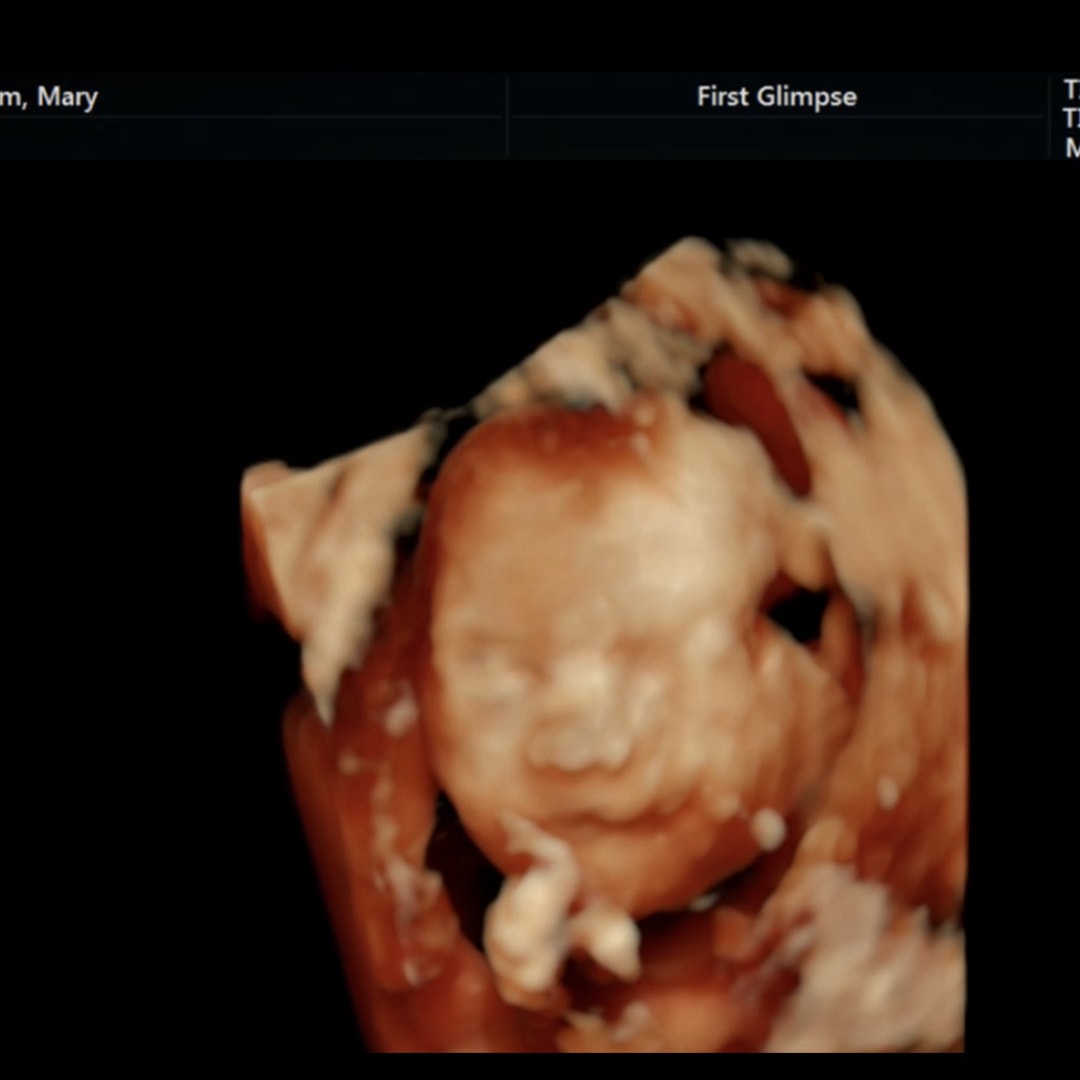 Photo shared by Mary Jo for their Babylist baby registry.