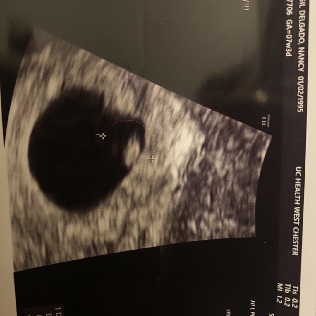 Photo shared by Nancy for their Babylist baby registry.