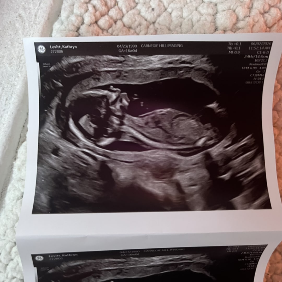 Photo shared by Katie for their Babylist baby registry.