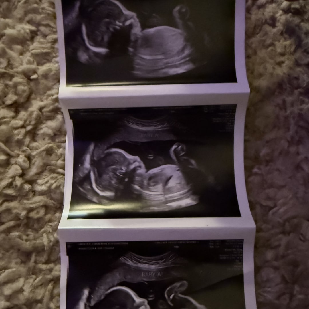 Photo shared by Cameron for their Babylist baby registry.