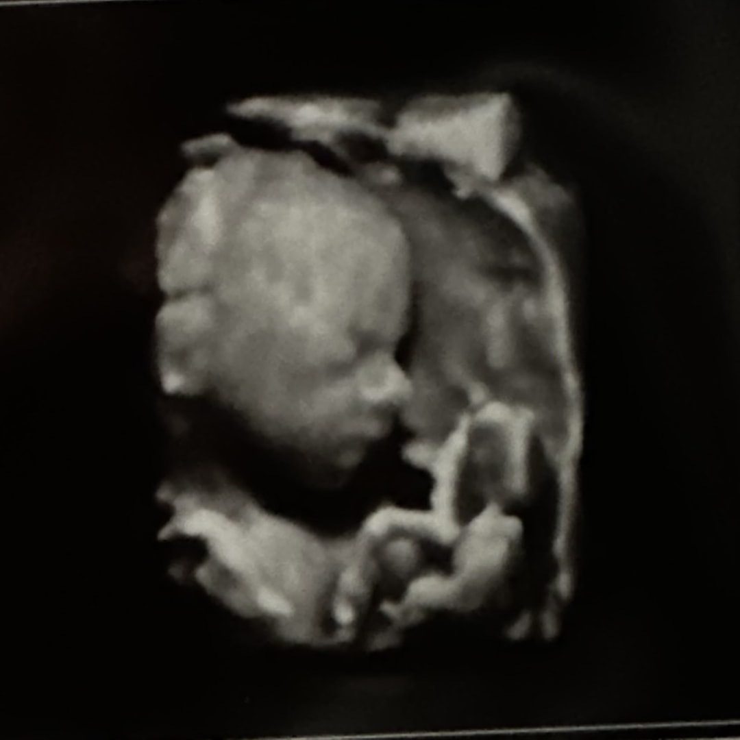 Photo shared by Kailey for their Babylist baby registry.