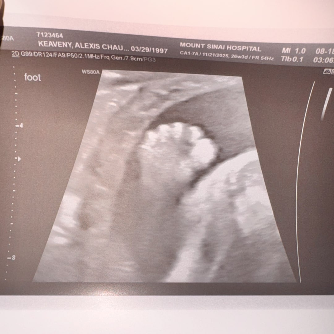 Photo shared by Alexis for their Babylist baby registry.