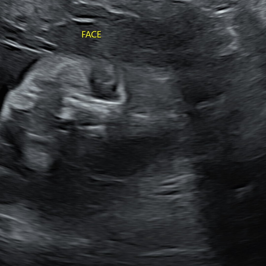 Photo shared by Jeanine for their Babylist baby registry.