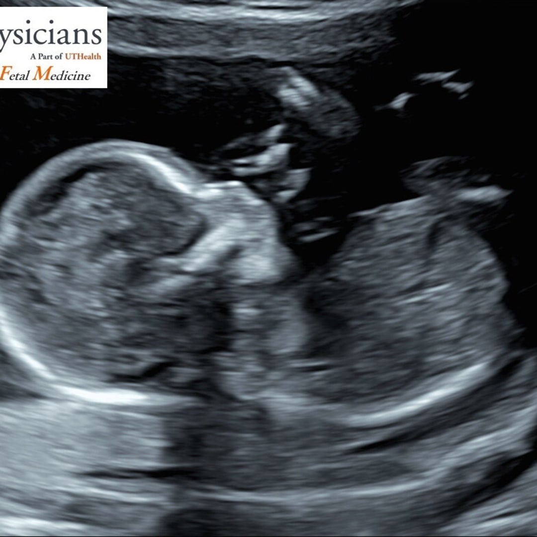Photo shared by Cheyanne for their Babylist baby registry.