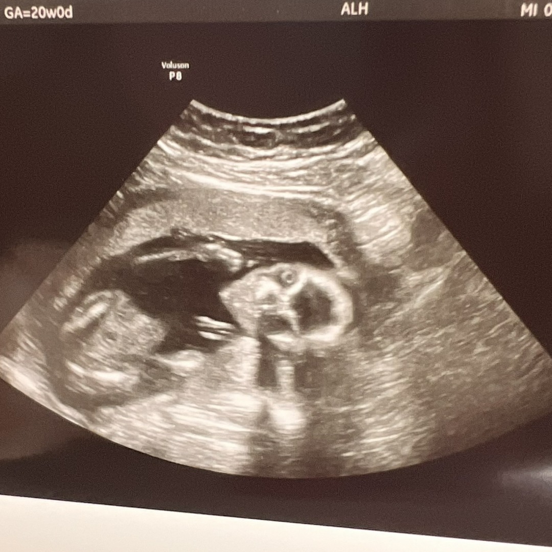 Photo shared by María for their Babylist baby registry.