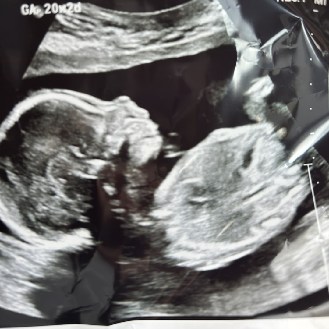 Photo shared by Chelsea for their Babylist baby registry.