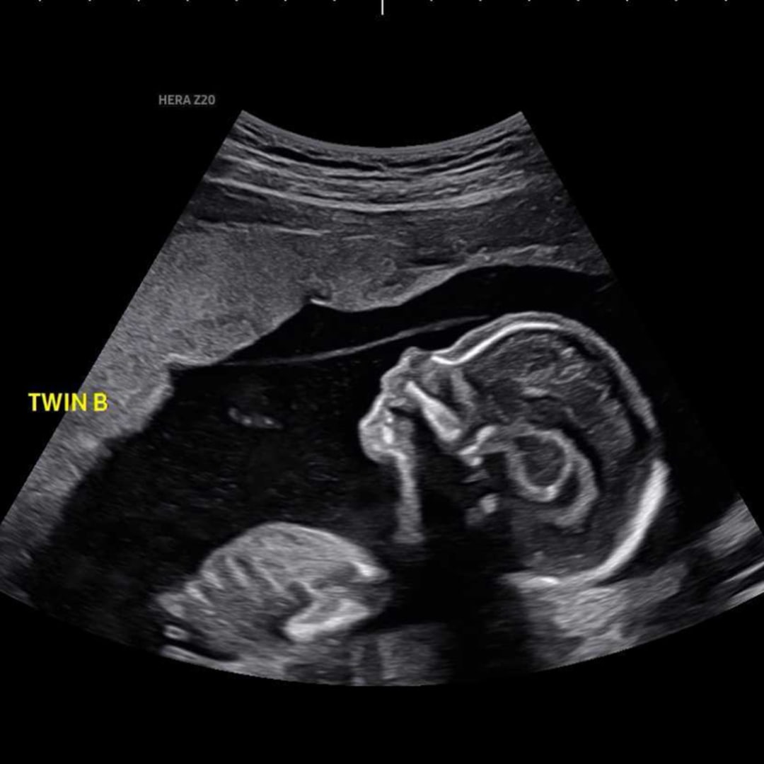 Photo shared by Kailyn for their Babylist baby registry.