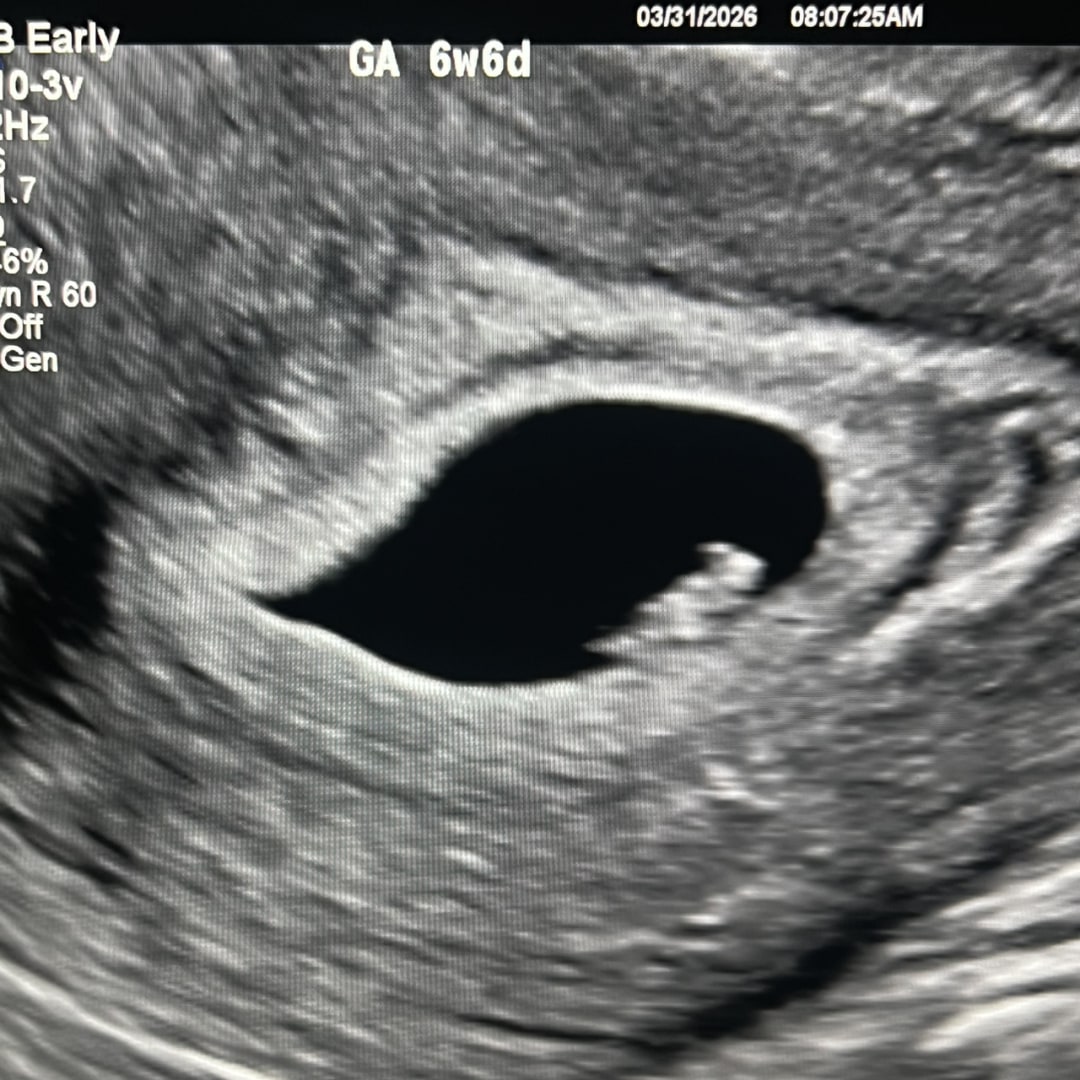 Photo shared by Cassie for their Babylist baby registry.