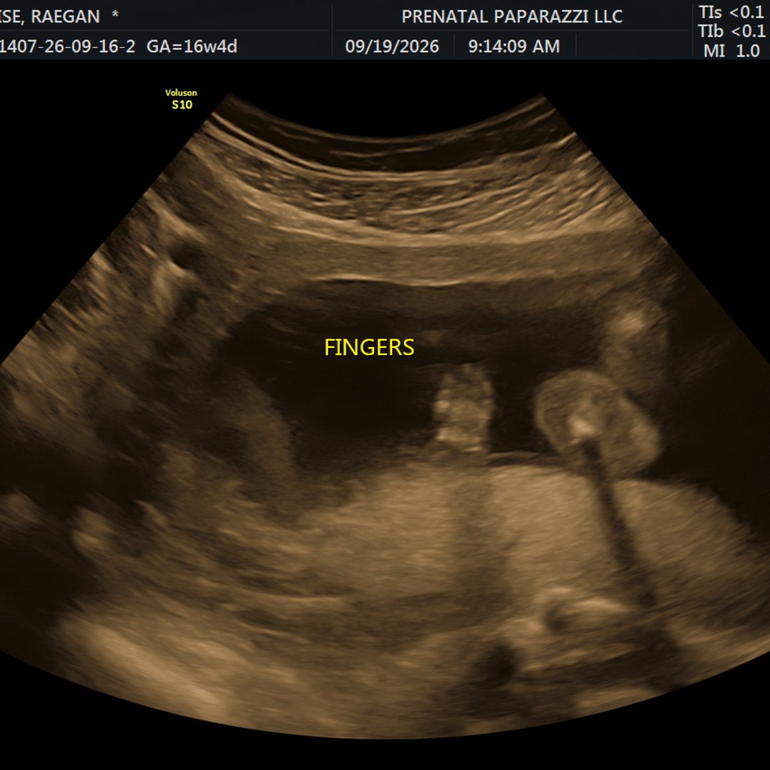 Photo shared by Raegan for their Babylist baby registry.