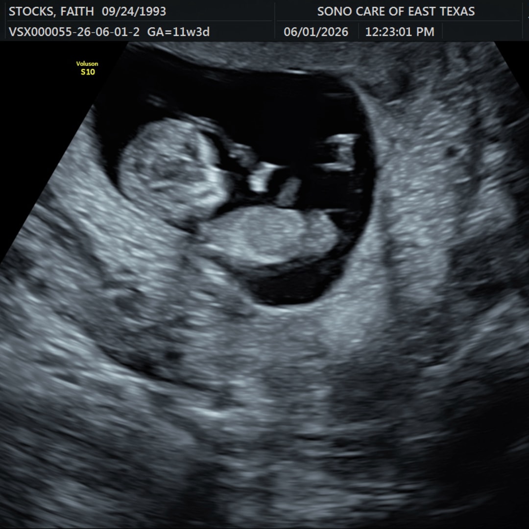 Photo shared by Faith for their Babylist baby registry.
