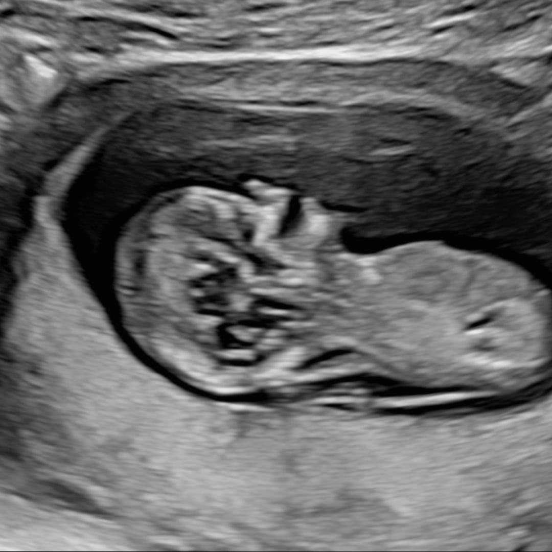 Photo shared by Angelina for their Babylist baby registry.