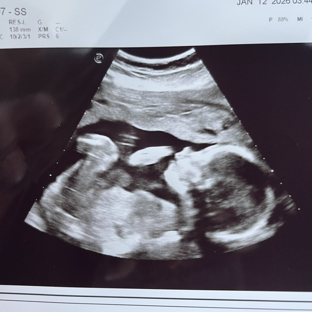 Photo shared by Ali for their Babylist baby registry.