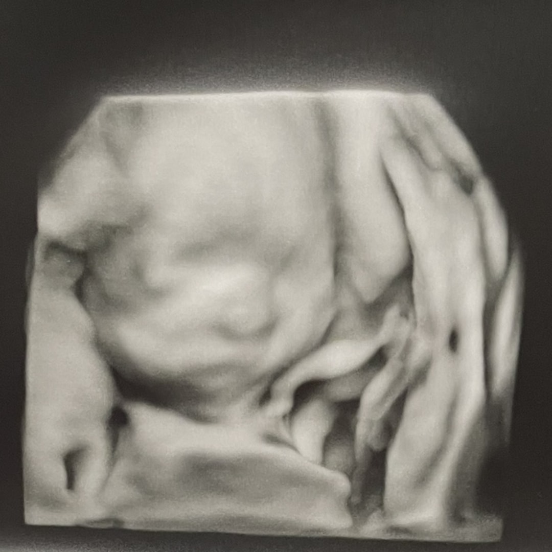 Photo shared by Olivia for their Babylist baby registry.