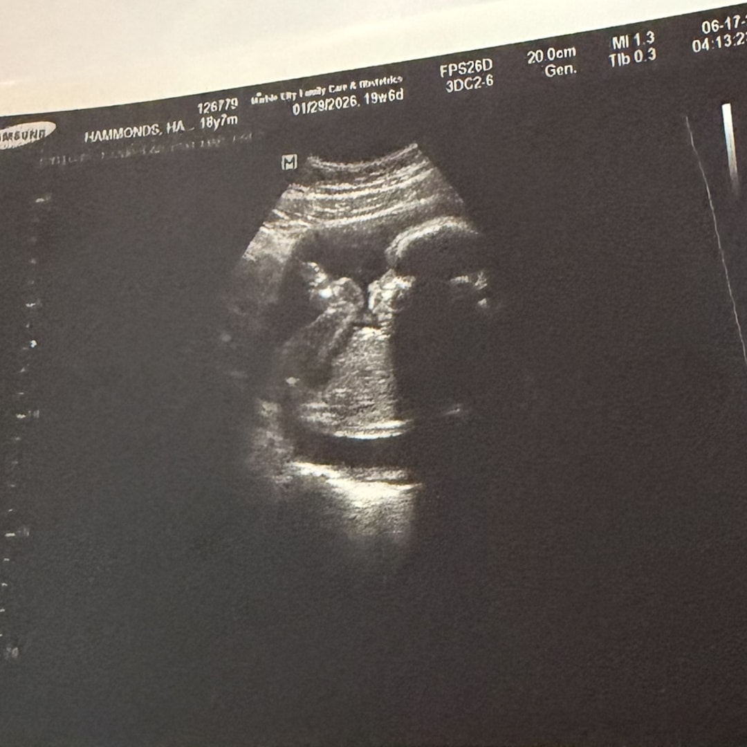 Photo shared by Hailey for their Babylist baby registry.