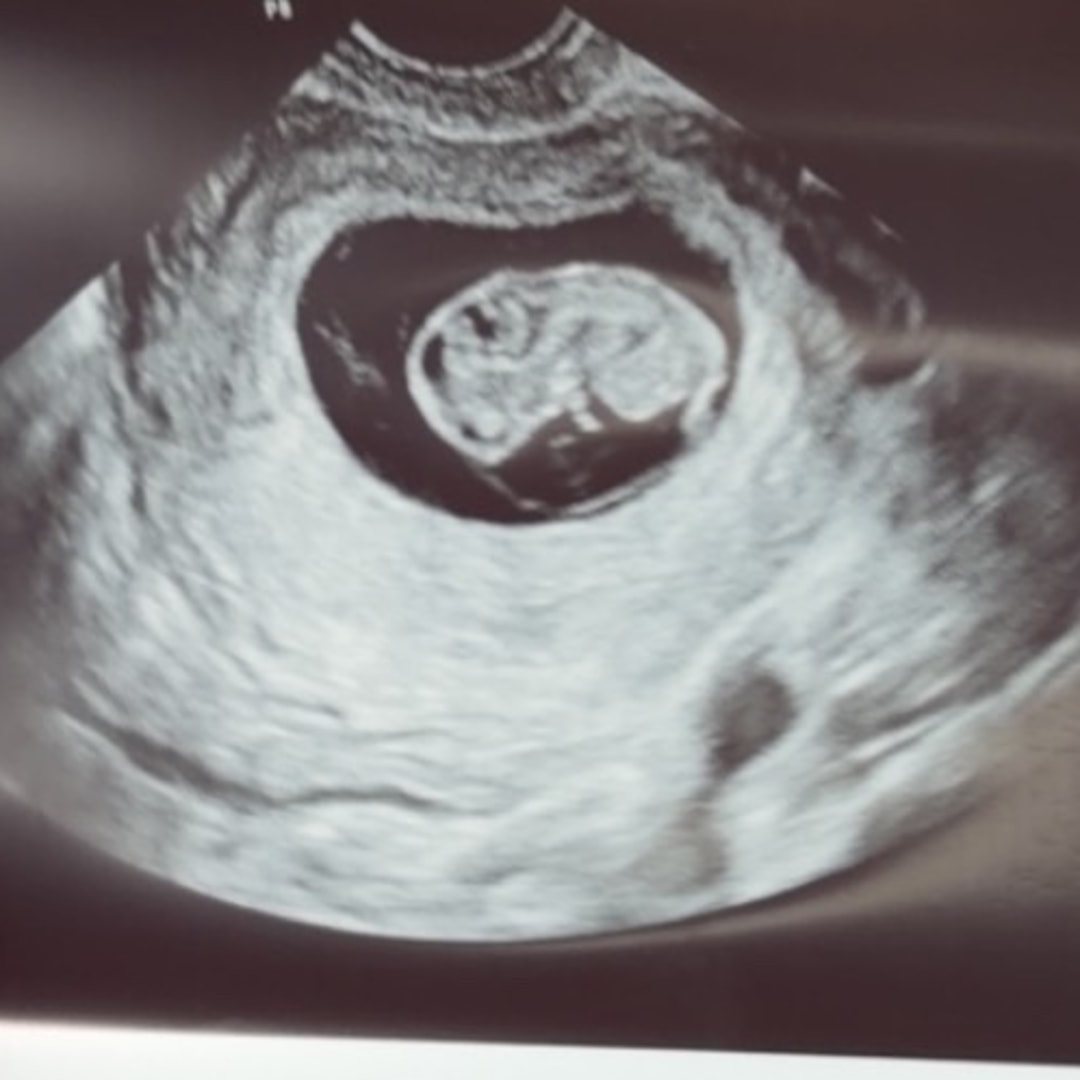 Photo shared by Aubri for their Babylist baby registry.