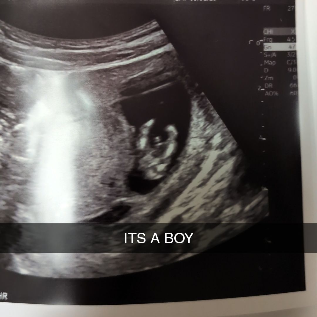 Photo shared by Catherine for their Babylist baby registry.